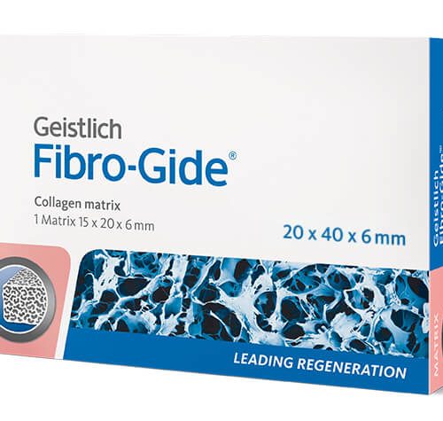 Fibro-Gide - Fibro-Gide 20х40х6мм